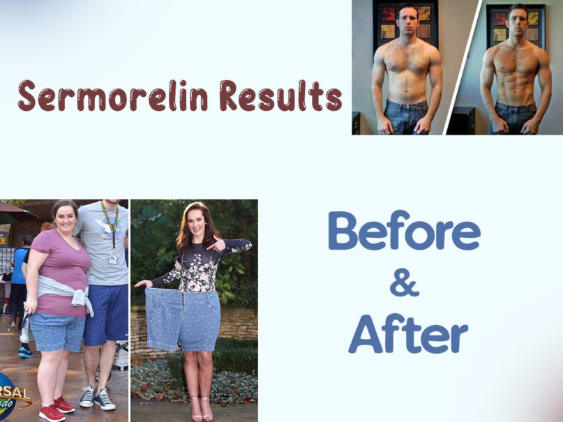 Sermorelin Before and After Results Changes Reported by Patients