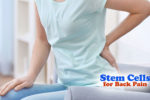 Cost of Stem Cell Therapy for Back Pain Reviewing the Prices