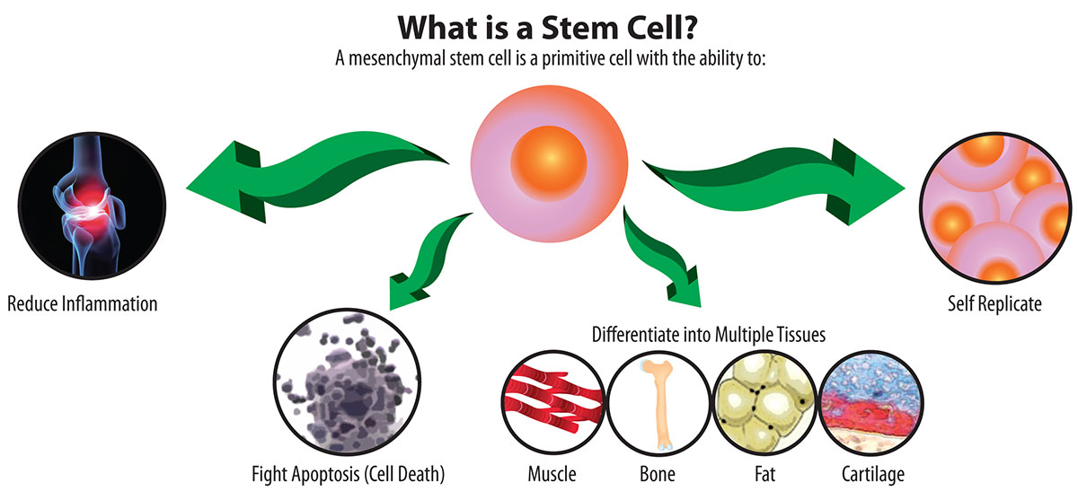 How Much Does Stem Cell Therapy Cost Essence of Stem Cell