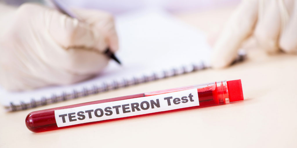 How to Get a Doctor to Prescribe Testosterone Test in a Tube