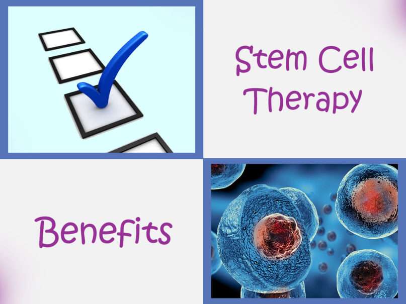 op 7 Benefits of Stem Cell Therapy